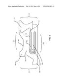 COMPONENT AND LOW PROFILE FLEXIBLE LATCH ASSEMBLY diagram and image