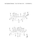 WEDGE FOR STATOR HAVING OVERMOLDED INSULATION diagram and image