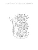 WEDGE FOR STATOR HAVING OVERMOLDED INSULATION diagram and image