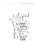 WEDGE FOR STATOR HAVING OVERMOLDED INSULATION diagram and image