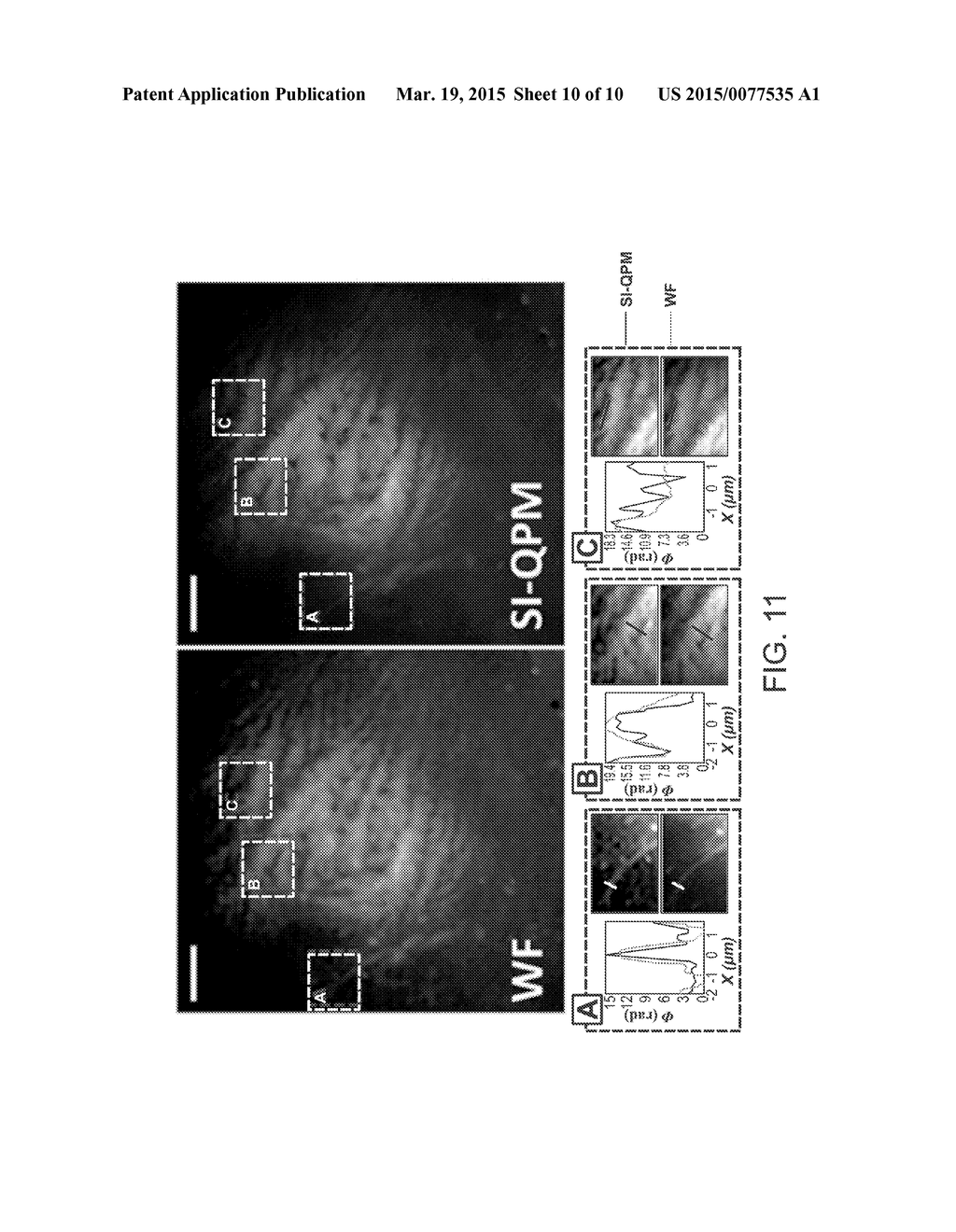 SYSTEMS AND METHODS FOR STRUCTURED ILLUMINATION SUPER-RESOLUTION PHASE     MICROSCOPY - diagram, schematic, and image 11