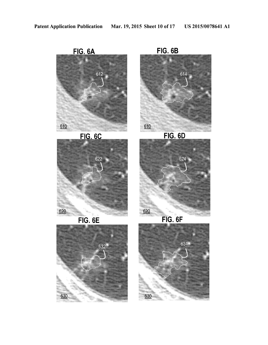 Techniques for Segmentation of Lymph Nodes, Lung Lesions and Other Solid     or Part-Solid Objects - diagram, schematic, and image 11