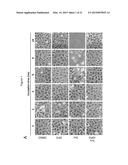 Compounds, Compositions, and Methods  For Modulating Ferroptosis and     Treating Excitotoxic Disorders diagram and image