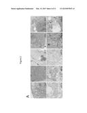 Compounds, Compositions, and Methods  For Modulating Ferroptosis and     Treating Excitotoxic Disorders diagram and image