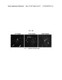 USE OF AN ANTI-ANG2 ANTIBODY diagram and image