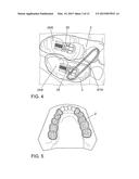 APPARATUS FOR TEMPOROMANDIBULAR JOINT-RELATED CORRECTIONS OF TOOTH     POSITION diagram and image