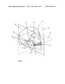 APPARATUS FOR TEMPOROMANDIBULAR JOINT-RELATED CORRECTIONS OF TOOTH     POSITION diagram and image