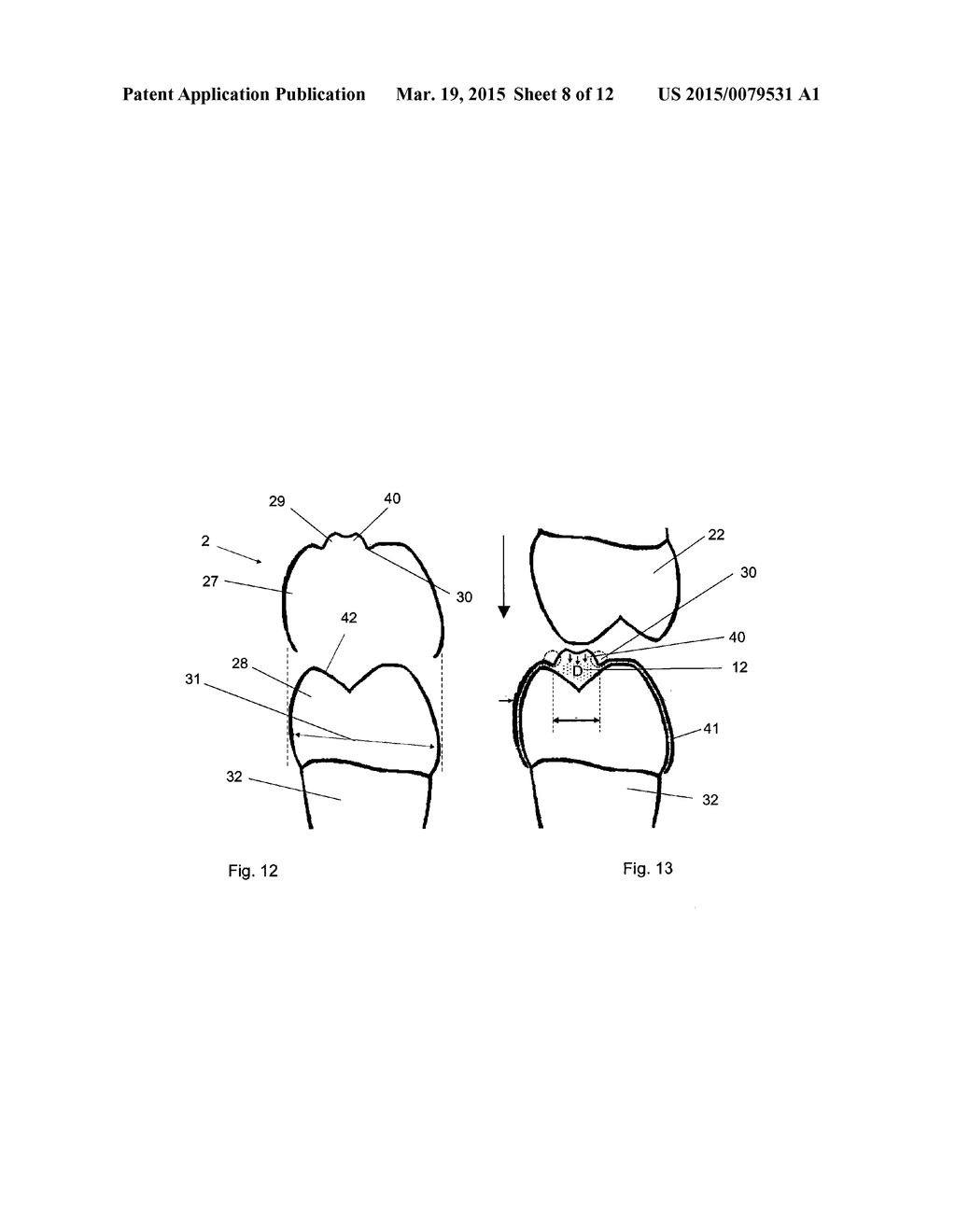 APPARATUS FOR TEMPOROMANDIBULAR JOINT-RELATED CORRECTIONS OF TOOTH     POSITION - diagram, schematic, and image 09