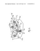 IMPLANT-BASED ATTACHMENT SYSTEM FOR DENTAL IMPLANT SURGICAL GUIDE AND     METHOD diagram and image