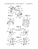 Dental Retractor For Use in Teeth Whitening diagram and image