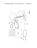 TRAINING SIMULATOR FOR MECHANICAL VENTILATION diagram and image