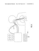 TRAINING SIMULATOR FOR MECHANICAL VENTILATION diagram and image