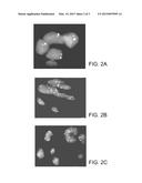 METHODS AND MATERIALS FOR DETECTING GENE AMPLIFICATION diagram and image