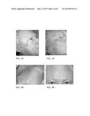 PORIFERA-BASED THERAPEUTIC COMPOSITIONS FOR TREATING AND PREVENTING SKIN     DISEASES diagram and image