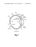 METHOD OF REDUCING INTRAOCULAR PRESSURE IN HUMANS diagram and image