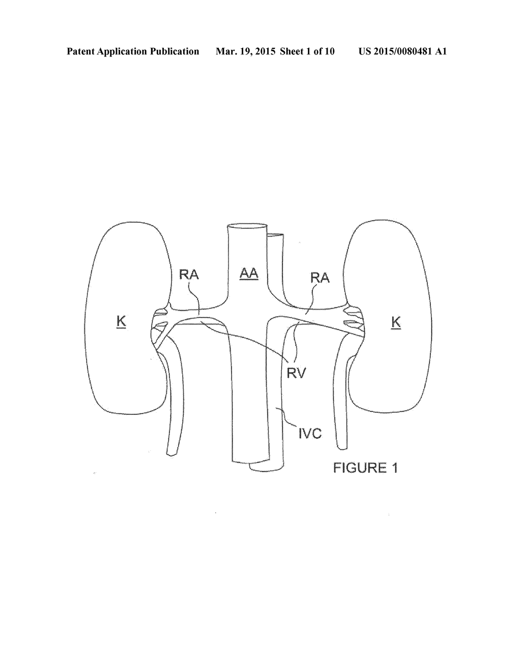 Methods for renal neuromodulation - diagram, schematic, and image 02