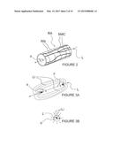 Methods for renal neuromodulation diagram and image