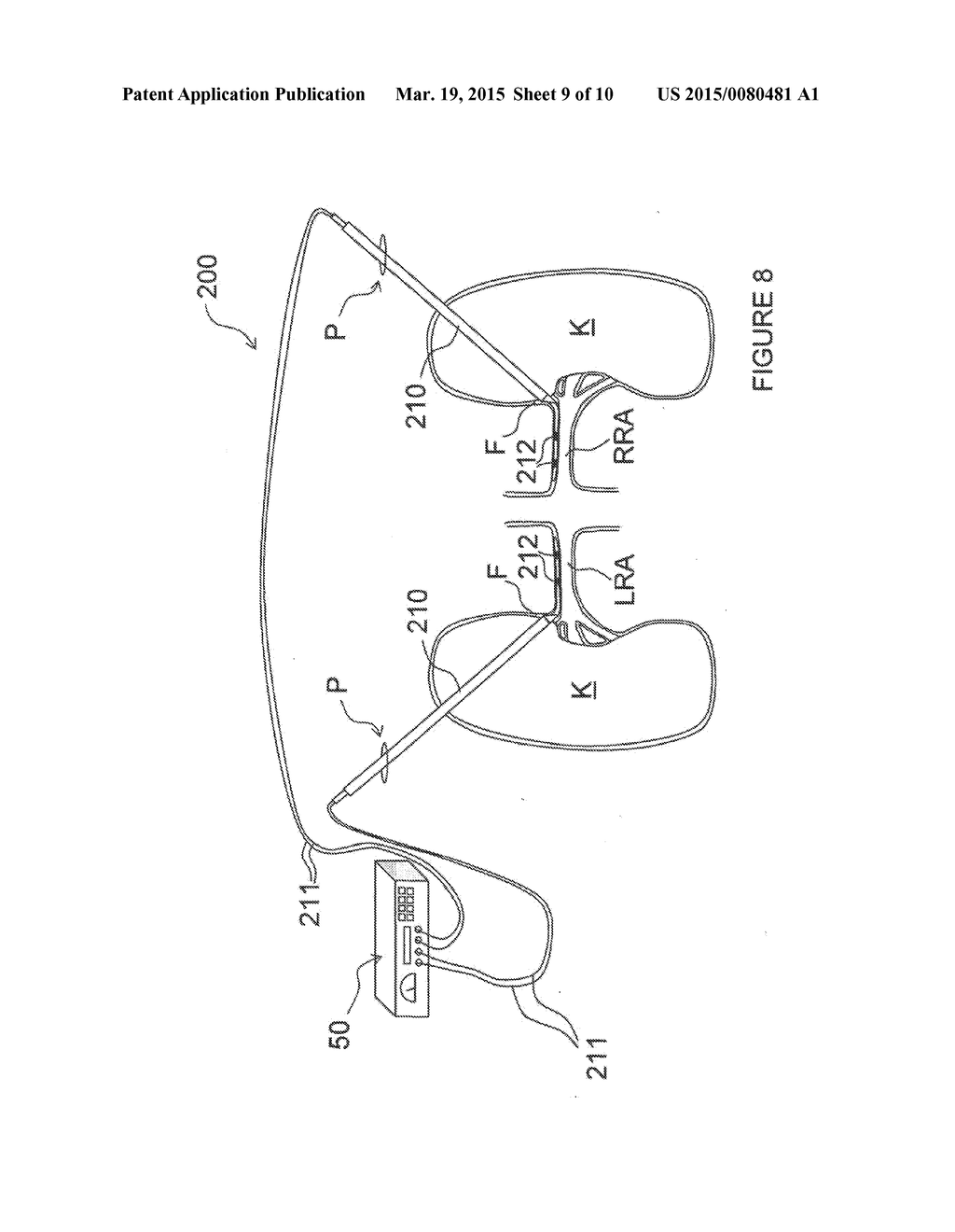 Methods for renal neuromodulation - diagram, schematic, and image 10