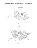 PARTICLE BEAM SCANNING IRRADIATION SYSTEM diagram and image