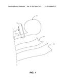 SUB-URETHRAL SLING DELIVERY DEVICE diagram and image