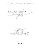 SUB-URETHRAL SLING DELIVERY DEVICE diagram and image