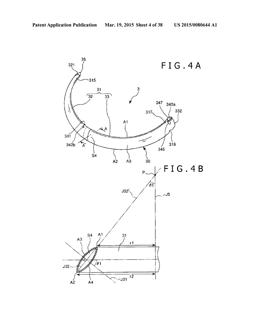 IMPLANT AND METHOD OF PLACING IMPLANT INDWELLING - diagram, schematic, and image 05