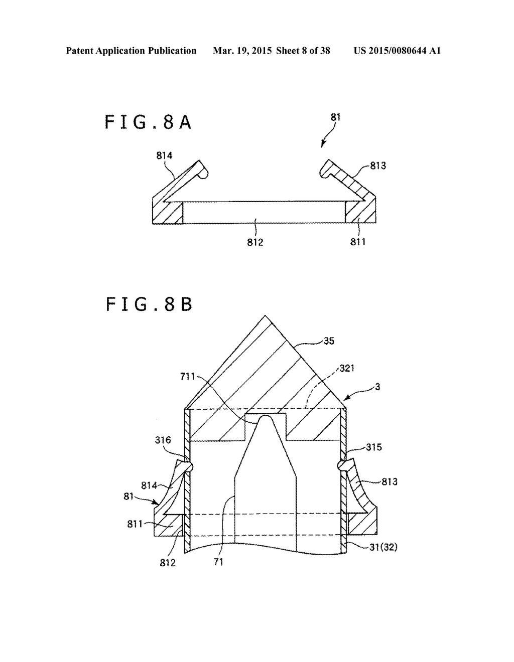 IMPLANT AND METHOD OF PLACING IMPLANT INDWELLING - diagram, schematic, and image 09