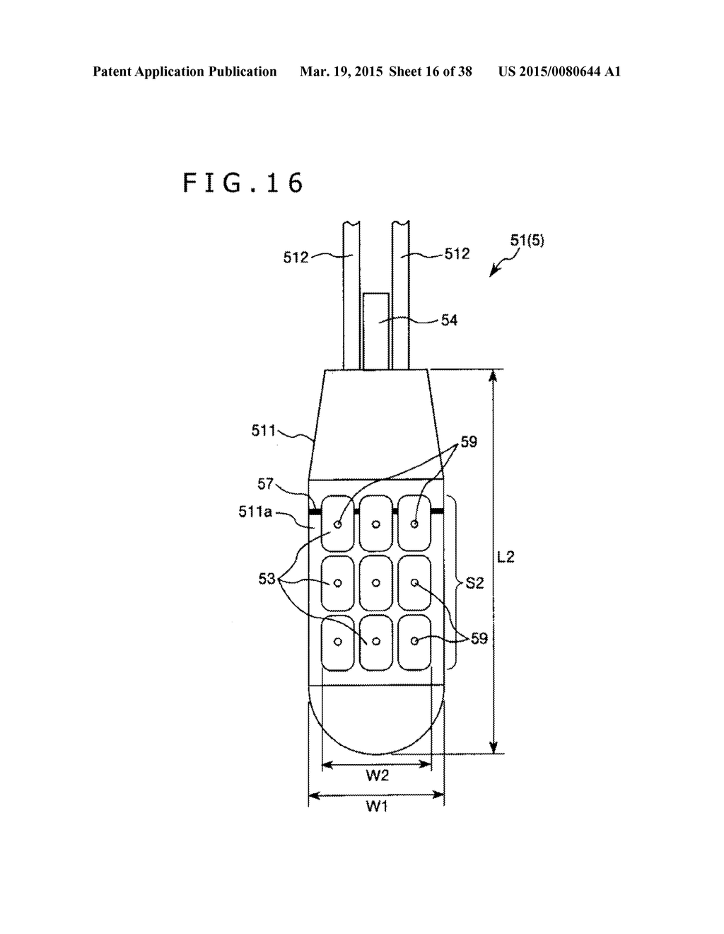 IMPLANT AND METHOD OF PLACING IMPLANT INDWELLING - diagram, schematic, and image 17