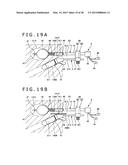 IMPLANT AND METHOD OF PLACING IMPLANT INDWELLING diagram and image