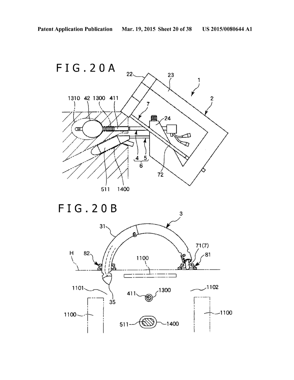 IMPLANT AND METHOD OF PLACING IMPLANT INDWELLING - diagram, schematic, and image 21