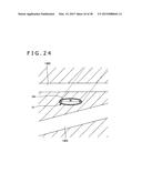 IMPLANT AND METHOD OF PLACING IMPLANT INDWELLING diagram and image