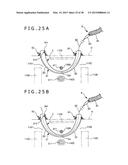 IMPLANT AND METHOD OF PLACING IMPLANT INDWELLING diagram and image