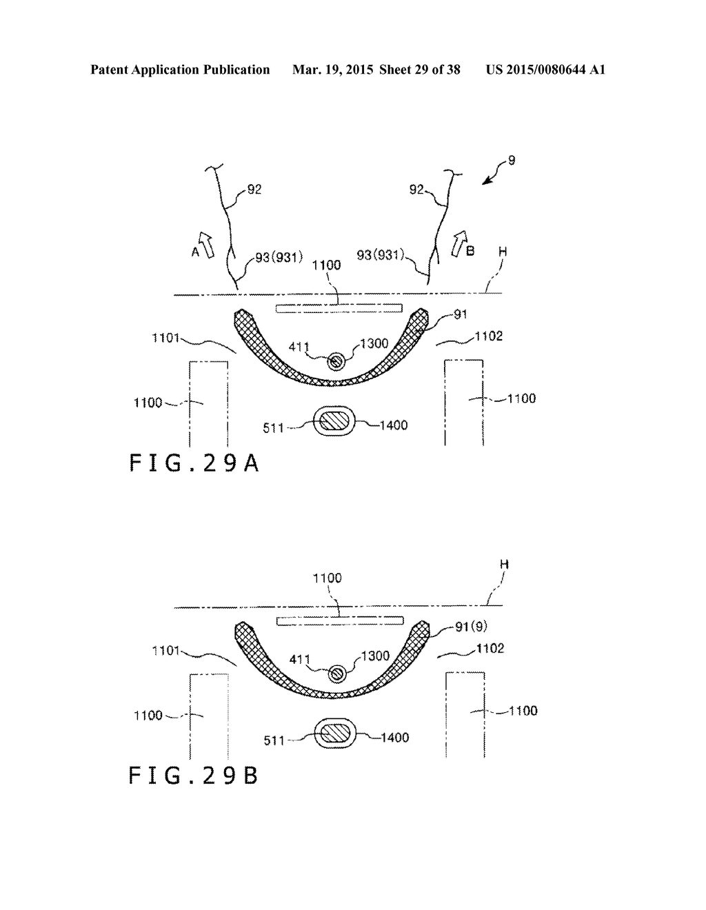 IMPLANT AND METHOD OF PLACING IMPLANT INDWELLING - diagram, schematic, and image 30