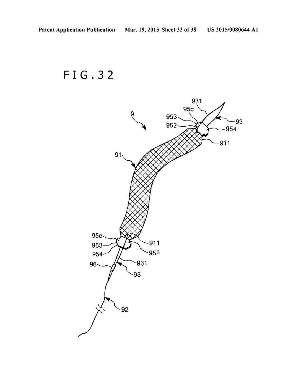 IMPLANT AND METHOD OF PLACING IMPLANT INDWELLING - diagram, schematic, and image 33