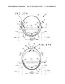 IMPLANT AND METHOD OF PLACING IMPLANT INDWELLING diagram and image