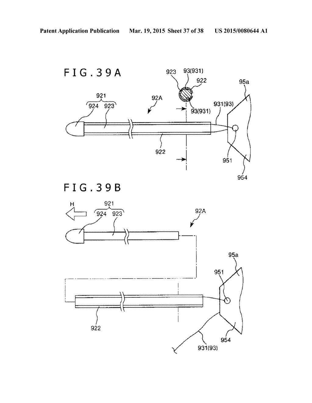 IMPLANT AND METHOD OF PLACING IMPLANT INDWELLING - diagram, schematic, and image 38