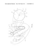 INTRACORPOREAL IMAGING AID (IMA) diagram and image