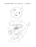 INTRACORPOREAL IMAGING AID (IMA) diagram and image