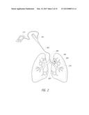 APPARATUSES, METHODS, AND SYSTEMS FOR THE IDENTIFICATION AND TREATMENT OF     PULMONARY TISSUE diagram and image