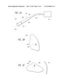 APPARATUSES, METHODS, AND SYSTEMS FOR THE IDENTIFICATION AND TREATMENT OF     PULMONARY TISSUE diagram and image