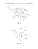 APPARATUSES, METHODS, AND SYSTEMS FOR THE IDENTIFICATION AND TREATMENT OF     PULMONARY TISSUE diagram and image