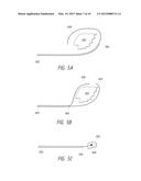 APPARATUSES, METHODS, AND SYSTEMS FOR THE IDENTIFICATION AND TREATMENT OF     PULMONARY TISSUE diagram and image