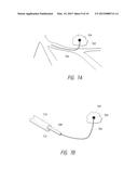 APPARATUSES, METHODS, AND SYSTEMS FOR THE IDENTIFICATION AND TREATMENT OF     PULMONARY TISSUE diagram and image