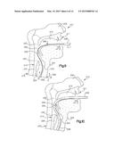 Medical device system including guide rod illumination diagram and image