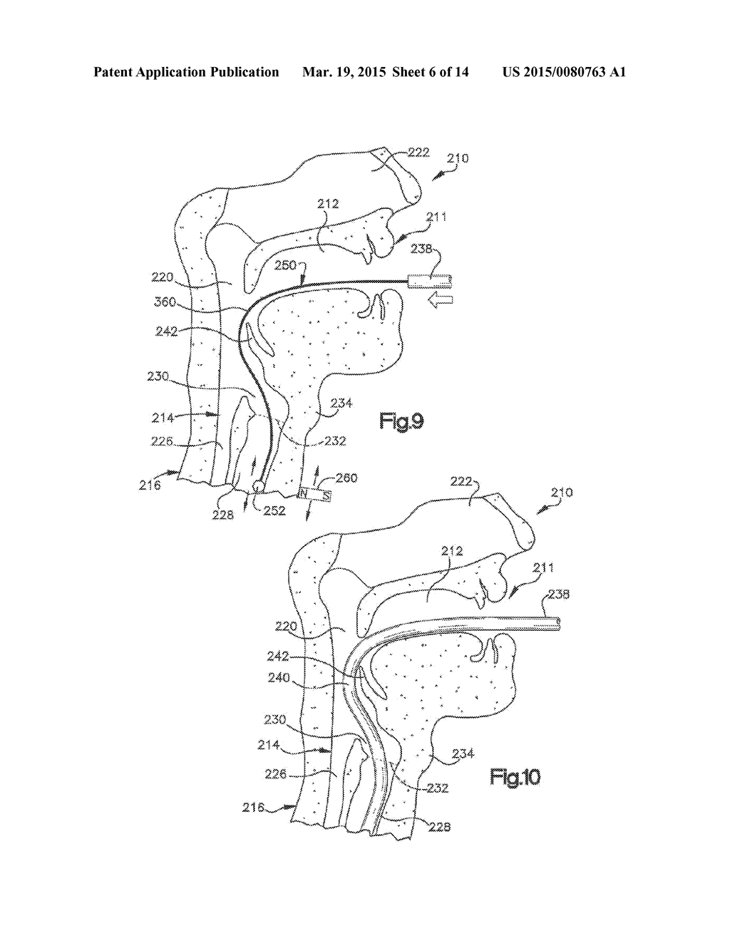 Medical device system including guide rod illumination - diagram, schematic, and image 07