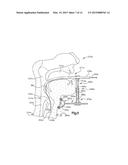 Medical device system including guide rod illumination diagram and image