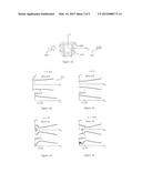 Methods and Systems for Ultrasound Treatment diagram and image