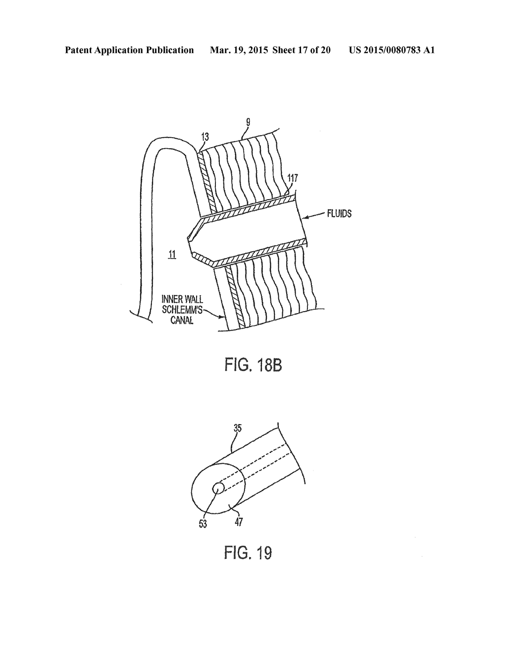 Delivery System and Method of Use for the Eye - diagram, schematic, and image 18