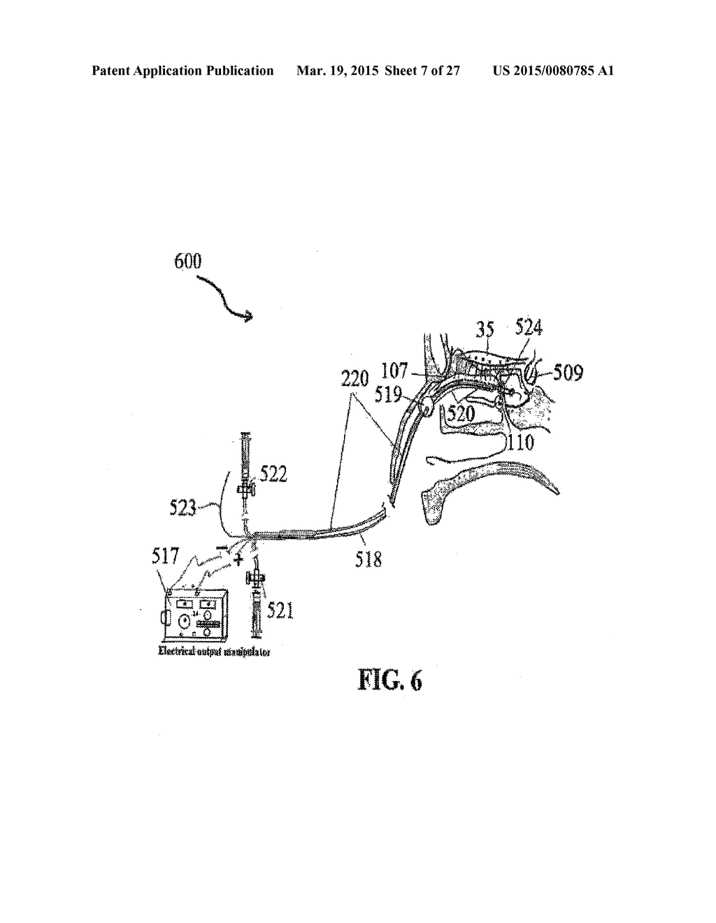 ALZHEIMER'S DISEASE TREATMENT WITH MULTIPLE THERAPEUTIC AGENTS DELIVERED     TO THE OLFACTORY REGION THROUGH A SPECIAL DELIVERY CATHETER AND     IONTOPHORESIS - diagram, schematic, and image 08