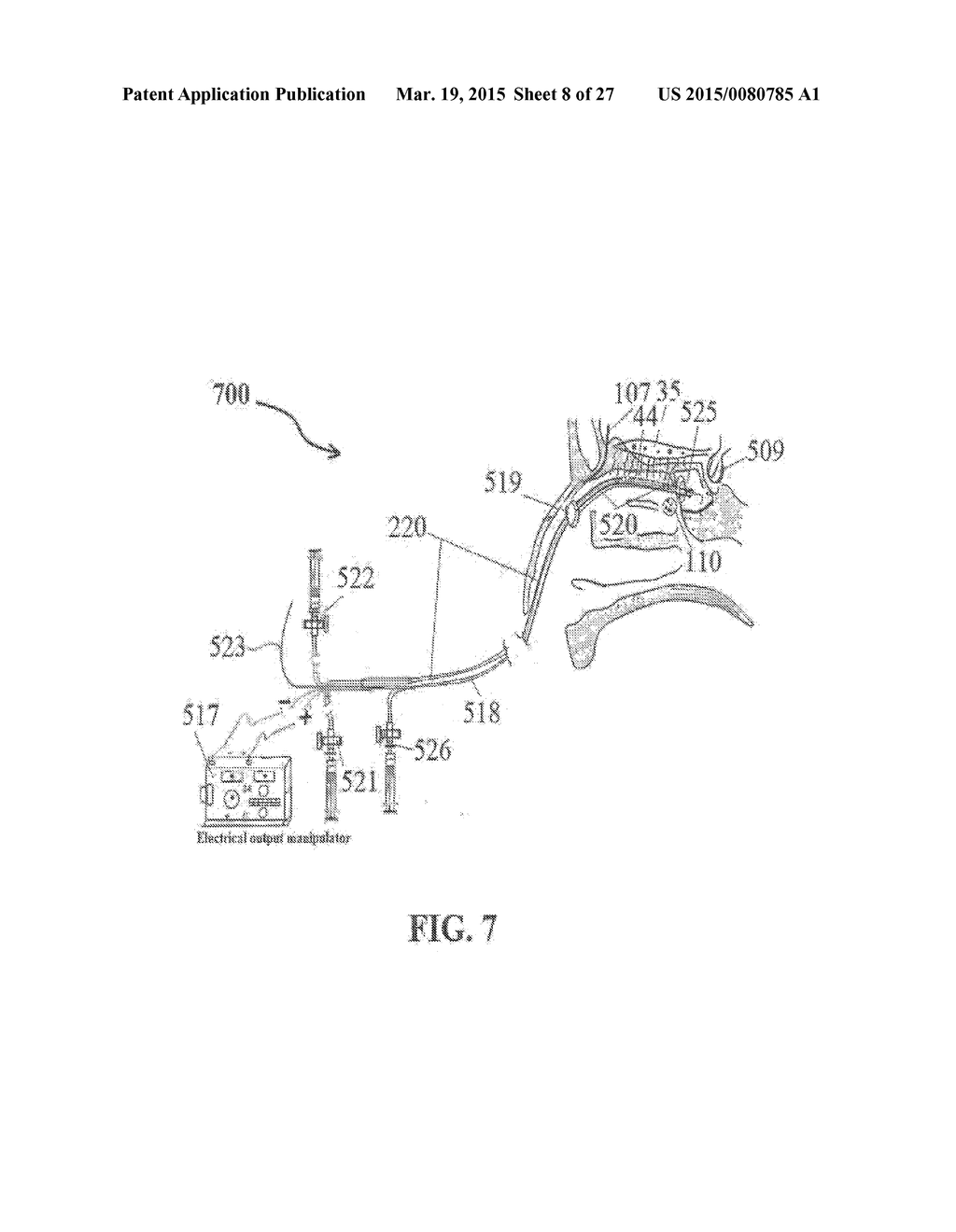 ALZHEIMER'S DISEASE TREATMENT WITH MULTIPLE THERAPEUTIC AGENTS DELIVERED     TO THE OLFACTORY REGION THROUGH A SPECIAL DELIVERY CATHETER AND     IONTOPHORESIS - diagram, schematic, and image 09